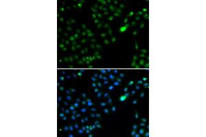 Immunofluorescence analysis of HeLa cells using FKBP3 antibody. (FKBP3 Antikörper)