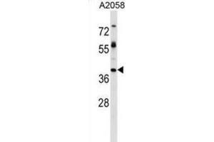 Western Blotting (WB) image for anti-Trophoblast Glycoprotein (TPBG) antibody (ABIN2999221) (TPBG Antikörper)