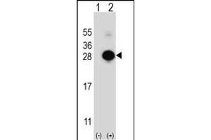 Western blot analysis of MOBKL1B (arrow) using rabbit polyclonal MOBKL1B Antibody (C-term) (ABIN391568 and ABIN2841505).