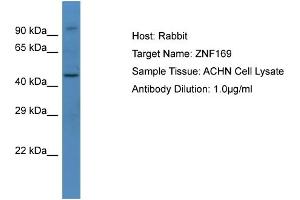 Host: Rabbit Target Name: ZNF169 Sample Type: ACHN Whole cell lysates Antibody Dilution: 1.