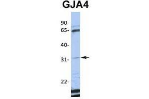 Western Blotting (WB) image for anti-Gap Junction Protein, alpha 4, 37kDa (GJA4) (Middle Region) antibody (ABIN2774856)