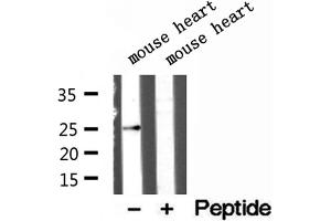 Western blot analysis of extracts of mouse heart tissue, using ATP5F1 antibody. (ATP5F1 Antikörper  (Internal Region))