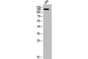 Western Blot analysis of 293 cells using ADAMTS-19 Polyclonal Antibody (ADAMTS19 Antikörper  (Internal Region))