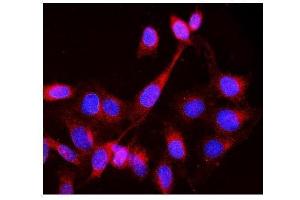 IF analysis of Lck using anti-Lck antibody (ABIN3043870). (LCK Antikörper  (C-Term))
