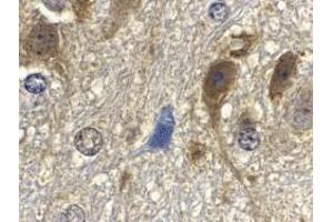 Immunohistochemistry of GbL in mouse brain tissue with GbL antibody at 10 μg/ml.