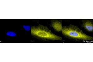 Immunocytochemistry/Immunofluorescence analysis using Rabbit Anti-Ubiquitin Polyclonal Antibody . (Ubiquitin Antikörper  (Biotin))