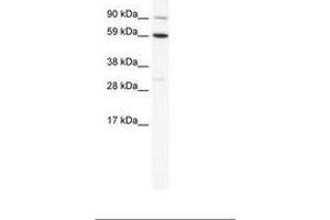 Image no. 1 for anti-T-Bet (AA 455-504) antibody (ABIN202721) (T-Bet Antikörper  (AA 455-504))
