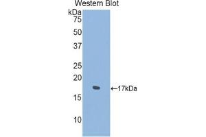 Western blot analysis of the recombinant protein. (SEMA4D/CD100 Antikörper  (AA 502-636))