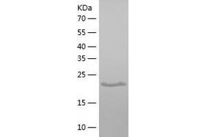 Western Blotting (WB) image for Glutathione Transferase zeta 1 (Maleylacetoacetate Isomerase) (GSTZ1) (AA 1-216) protein (His tag) (ABIN7123154)