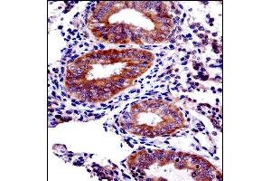 PHF16 Antibody (C-term) ((ABIN1537593 and ABIN2848809))immunohistochemistry analysis in formalin fixed and paraffin embedded human uterus tissue followed by peroxidase conjugation of the secondary antibody and DAB staining. (PHF16 Antikörper  (C-Term))