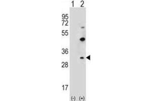 Western Blotting (WB) image for anti-Claudin 2 (CLDN2) antibody (ABIN2996860) (Claudin 2 Antikörper)