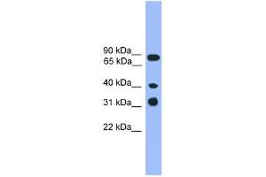 WB Suggested Anti-LAX1 Antibody Titration: 0.