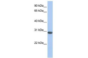 MLF1 antibody used at 1 ug/ml to detect target protein.