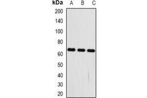 Western blot analysis of FRZB expression in mouse kidney (A), mouse heart (B), mouse brain (C) whole cell lysates. (FRZB Antikörper)