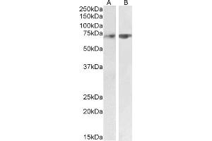 ABIN1590085 (2 μg/mL) staining of Human Cerebellum (A) and Rat Lung (B) lysate (35 μg protein in RIPA buffer). (SYVN1 Antikörper  (Internal Region))