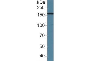 Detection of AIM1 in Human 293T cell lysate using Polyclonal Antibody to Absent In Melanoma 1 (AIM1) (AIM1 Antikörper  (AA 1502-1719))