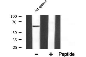 Western blot analysis of NF-kappaB p65 expression in Rat spleen lysate (NF-kB p65 Antikörper)