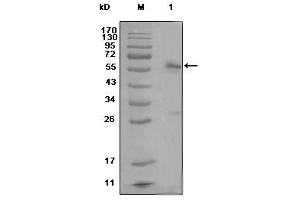 Western blot analysis using ESR1 mouse mAb against MCF-7 cell lysate (1)