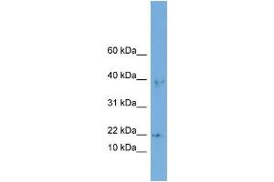 WB Suggested Anti-ARPC3  Antibody Titration: 0. (ARPC3 Antikörper  (Middle Region))