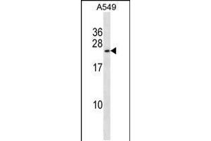 Western blot analysis in A549 cell line lysates (35ug/lane).