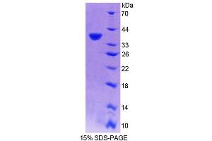 SDS-PAGE (SDS) image for Ribonuclease H2, Subunit A (RNASEH2A) (AA 1-299) protein (His tag) (ABIN6239259)