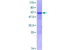 TTC33 Protein (AA 1-262) (GST tag)