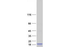Western Blotting (WB) image for LIM Domain Containing 2 (LIMD2) protein (Myc-DYKDDDDK Tag) (ABIN2724732)
