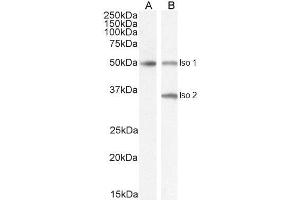 ABIN185645 (2µg/ml) staining of isoform 1 Human Brain (A) and isoform 1+2 (B) lysate (35µg protein in RIPA buffer). (Chromogranin A Antikörper  (Internal Region))