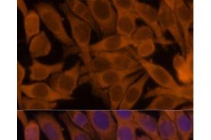 Immunofluorescence analysis of HeLa cells using NME1 Polyclonal Antibody at dilution of 1:100. (NME1 Antikörper)