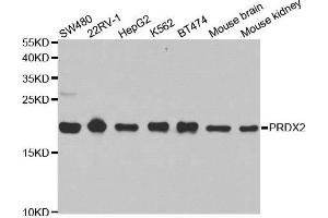 Western blot analysis of extracts of various cell lines, using PRDX2 antibody. (Peroxiredoxin 2 Antikörper  (AA 1-142))