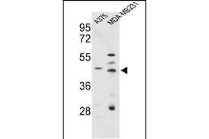 Western blot analysis of CTSD Antibody (C-term) (ABIN653399 and ABIN2842857) in , MDA-M cell line lysates (35 μg/lane). (Cathepsin D Antikörper  (C-Term))