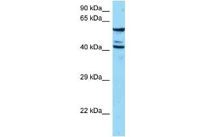 WB Suggested Anti-ESAM Antibody   Titration: 1. (ESAM Antikörper  (N-Term))