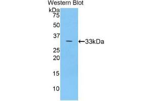Western blot analysis of the recombinant protein. (Ceruloplasmin Antikörper  (AA 789-1065))