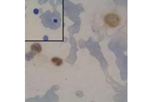 Immunocytochemical staining of HL-60 cell using PML polyclonal antibody . (PML Antikörper)