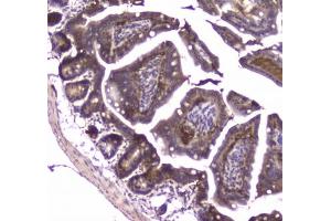 Immunohistochemistry (IHC) image for anti-Major Vault Protein (MVP) antibody (ABIN5708257)