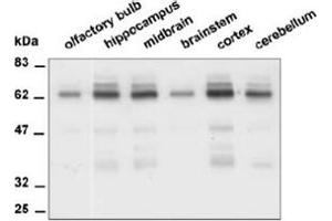 Western Blotting (WB) image for anti-Protein tyrosine Phosphatase, Receptor Type, R (PTPRR) antibody (ABIN1108794) (PTPRR Antikörper)