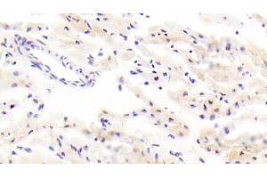 Detection of ITGb8 in Human Cardiac Muscle Tissue using Polyclonal Antibody to Integrin Beta 8 (ITGb8) (ITGB8 Antikörper  (AA 471-629))