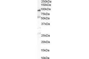 Western Blotting (WB) image for anti-Chitobiosyldiphosphodolichol beta-Mannosyltransferase (ALG1) (C-Term) antibody (ABIN2783688) (ALG1 Antikörper  (C-Term))