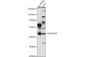 Western blot analysis of extracts of various cell lines, using NFIP antibody (ABIN7268978) at 1:1000 dilution. (NFATC2IP Antikörper  (AA 290-360))