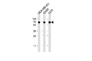 All lanes : Anti-CD63 Antibody (C-term) at 1:2000 dilution Lane 1: MDA-MB-453 whole cell lysate Lane 2:  whole cell lysate Lane 3:  whole cell lysate Lysates/proteins at 20 μg per lane. (CD63 Antikörper  (C-Term))