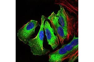 Immunofluorescence analysis of HeLa cells using MAPK14 mouse mAb (green). (MAPK14 Antikörper  (AA 299-360))