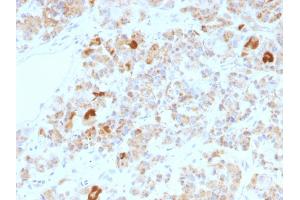 Formalin-fixed, paraffin-embedded human Pituitary stained with LH alpha Mouse Monoclonal Antibody (LHa/756). (CGA Antikörper)