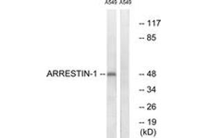 Western Blotting (WB) image for anti-Arrestin, beta 1 (ARRB1) (AA 369-418) antibody (ABIN2888645) (beta Arrestin 1 Antikörper  (AA 369-418))
