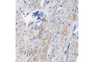 Immunohistochemistry of paraffin-embedded mouse heart using Cathepsin D antibody (ABIN7266149) at dilution of 1:100 (40x lens).
