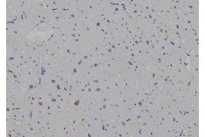 ABIN6259643 and ABIN6269296 at 1/100 staining Human heart tissue by IHC-P.