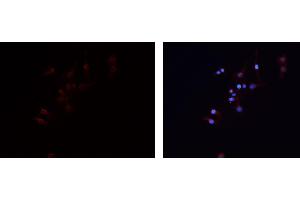 ABIN6279474 staining HEPG2 cells by IF/ICC.