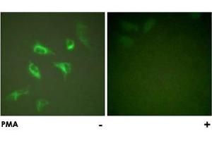 Immunofluorescence analysis of HeLa cells, treated with PMA (125 ng/mL, 30 mins), using YWHAZ polyclonal antibody . (14-3-3 zeta Antikörper)