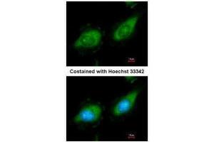 ICC/IF Image Immunofluorescence analysis of methanol-fixed HeLa, using MAP3K8, antibody at 1:200 dilution. (MAP3K8 Antikörper)