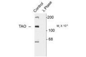 Image no. 1 for anti-TAO Kinase 2 (TAOK2) (pSer181) antibody (ABIN228235) (TAO Kinase 2 Antikörper  (pSer181))