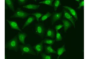 Immunofluorescence analysis of HeLa cells using TREX1 antibody. (TREX1 Antikörper  (AA 1-270))